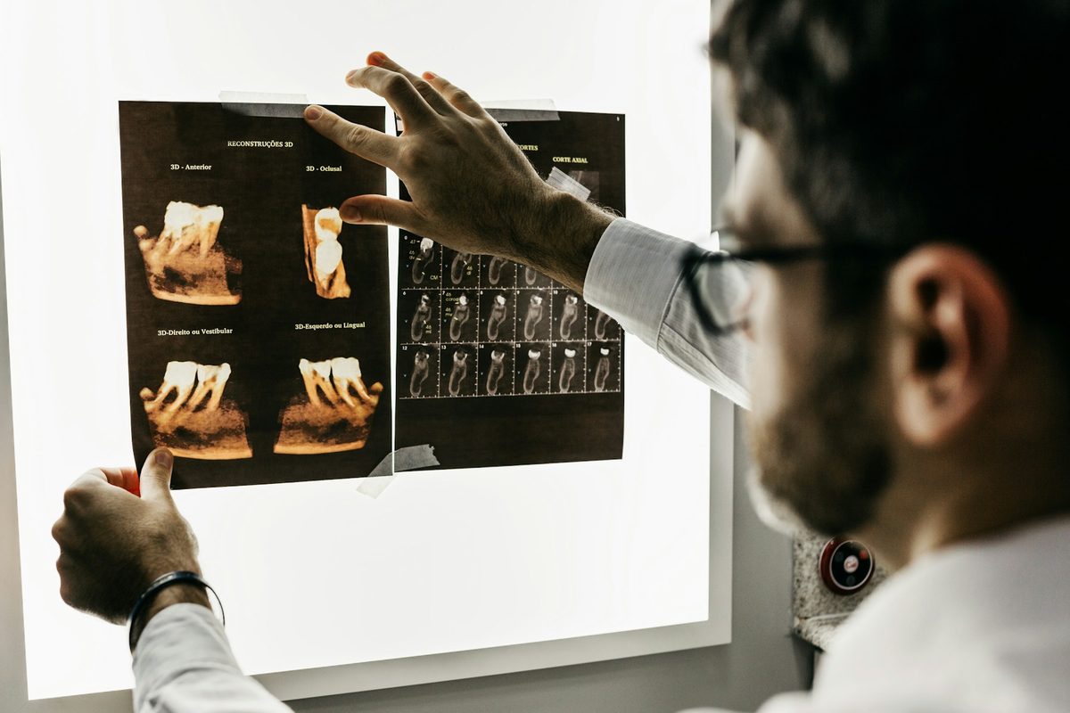 Dentista analisando radiografias odontológicas para avaliar o osso disponível